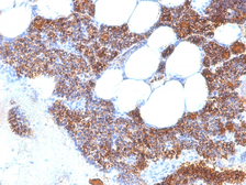 Anti-Parathyroid Hormone antibody [SPM604] used in IHC (Paraffin sections) (IHC-P). GTX34950