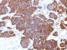 Anti-Parathyroid Hormone antibody [PTH/1173] used in IHC (Paraffin sections) (IHC-P). GTX34951