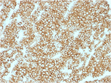 Anti-Parathyroid Hormone antibody [PTH/1717R] used in IHC (Paraffin sections) (IHC-P). GTX34954