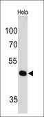 Anti-PAX7 antibody [PAX7/497] used in Western Blot (WB). GTX34958