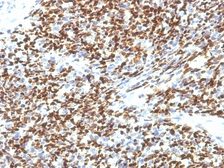 Anti-PAX7 antibody [SPM613] used in IHC (Paraffin sections) (IHC-P). GTX34960