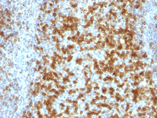 Anti-PD1 antibody [PDCD1/922] used in IHC (Paraffin sections) (IHC-P). GTX34966