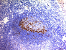 Anti-PD1 antibody [SPM597] used in IHC (Paraffin sections) (IHC-P). GTX34967