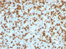 Anti-PD1 antibody [PDCD1/1410R] used in IHC (Paraffin sections) (IHC-P). GTX34968