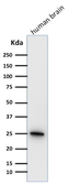 Anti-PGP9.5 antibody [31A3] used in Western Blot (WB). GTX34969