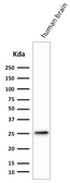 Anti-PGP9.5 antibody [SPM574] used in Western Blot (WB). GTX34970