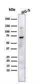 Anti-Placental Alkaline Phosphatase antibody [ALPP/870] used in Western Blot (WB). GTX34972