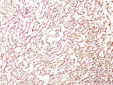 Anti-PODXL antibody [4F10] used in IHC (Paraffin sections) (IHC-P). GTX34978