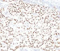 Anti-Progesterone Receptor antibody [PR484] used in IHC (Paraffin sections) (IHC-P). GTX34980