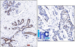 Anti-Progesterone Receptor antibody [PR501] used in IHC (Paraffin sections) (IHC-P). GTX34983
