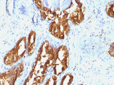 Anti-Prostatic Acid Phosphatase antibody [ACPP/1338] used in IHC (Paraffin sections) (IHC-P). GTX34987