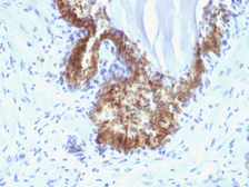 Anti-PSA antibody [KLK3/1248] used in IHC (Paraffin sections) (IHC-P). GTX34991