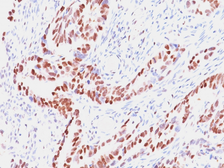 Anti-Rb antibody [SPM353] used in IHC (Paraffin sections) (IHC-P). GTX34994