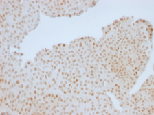 Anti-Rb antibody [RB1/1754] used in IHC (Paraffin sections) (IHC-P). GTX34995