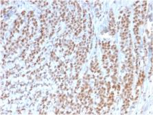Anti-Rb antibody [1F8] used in IHC (Paraffin sections) (IHC-P). GTX34996