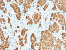 Anti-S100 beta antibody [S100B/1706R] used in IHC (Paraffin sections) (IHC-P). GTX34998