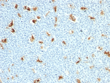Anti-S100A9 antibody [S100A9/1011] used in IHC (Paraffin sections) (IHC-P). GTX35018
