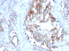 Anti-SHBG antibody [SPM605] used in IHC (Paraffin sections) (IHC-P). GTX35082
