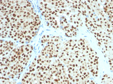 Anti-SOX10 antibody [SOX10/991] used in IHC (Paraffin sections) (IHC-P). GTX35083