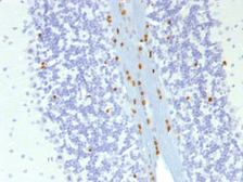 Anti-SOX10 antibody [SOX10/1074] used in IHC (Paraffin sections) (IHC-P). GTX35084