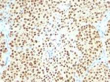 Anti-SOX10 antibody [SPM607] used in IHC (Paraffin sections) (IHC-P). GTX35085