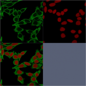 Anti-SPTBN2 antibody [SPTBN2/1583] used in Immunocytochemistry/ Immunofluorescence (ICC/IF). GTX35090