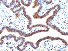 Anti-SUMO2 antibody [SUMO2/1199] used in IHC (Paraffin sections) (IHC-P). GTX35095
