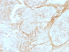 Anti-Tenascin C antibody [SPM319] used in IHC (Paraffin sections) (IHC-P). GTX35098