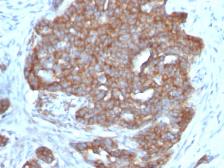 Anti-TFF1 antibody [TFF1/1091] used in IHC (Paraffin sections) (IHC-P). GTX35101