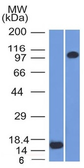 Anti-Thrombomodulin antibody [THBD/1591] used in Western Blot (WB). GTX35108