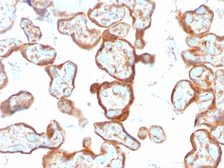 Anti-Thymidine Phosphorylase antibody [SPM322] used in IHC (Paraffin sections) (IHC-P). GTX35110