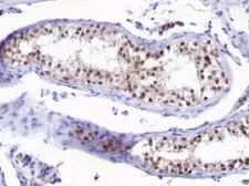 Anti-Thymidylate synthase antibody [SPM453] used in IHC (Paraffin sections) (IHC-P). GTX35113