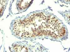 Anti-Thymidylate synthase antibody [TMS715] used in IHC (Paraffin sections) (IHC-P). GTX35114