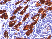 Anti-Thyroglobulin antibody [2H11] used in IHC (Paraffin sections) (IHC-P). GTX35115