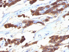 Anti-Thyroglobulin antibody [SPM221] used in IHC (Paraffin sections) (IHC-P). GTX35116