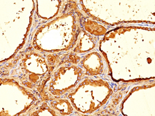 Anti-Thyroglobulin antibody [6E1] used in IHC (Paraffin sections) (IHC-P). GTX35117