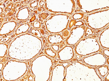 Anti-Thyroglobulin antibody [SPM517] used in IHC (Paraffin sections) (IHC-P). GTX35118