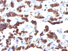 Anti-Thyroglobulin antibody [TGB24] used in IHC (Paraffin sections) (IHC-P). GTX35119