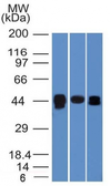 Anti-TIA1 antibody [TIA1/1313] used in Western Blot (WB). GTX35120