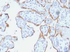 Anti-TIMP2 antibody [SPM356] used in IHC (Paraffin sections) (IHC-P). GTX35121