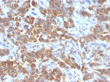 Anti-TL1A antibody [VEGI/1283] used in IHC (Paraffin sections) (IHC-P). GTX35124
