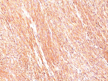 Anti-TMEM16A antibody [DG1/447] used in IHC (Paraffin sections) (IHC-P). GTX35125