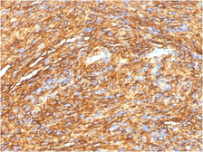 Anti-TMEM16A antibody [DG1/1484] used in IHC (Paraffin sections) (IHC-P). GTX35128