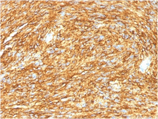 Anti-TMEM16A antibody [DG1/1485] used in IHC (Paraffin sections) (IHC-P). GTX35129