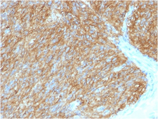 Anti-TMEM16A antibody [DG1/1486] used in IHC (Paraffin sections) (IHC-P). GTX35130