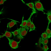 Anti-TNF alpha antibody [TNFA/1172] used in Immunocytochemistry/ Immunofluorescence (ICC/IF). GTX35131