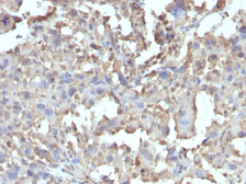Anti-TNF alpha antibody [TNF/1500R] used in IHC (Paraffin sections) (IHC-P). GTX35135
