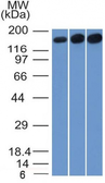 Anti-Topoisomerase II alpha antibody [TOP2A/1361] used in Western Blot (WB). GTX35137