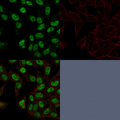 Anti-Topoisomerase II alpha antibody [TOP2A/1362] used in Immunocytochemistry/ Immunofluorescence (ICC/IF). GTX35138