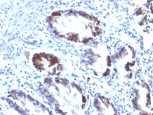 Anti-Transgelin antibody [TAGLN/247] used in IHC (Paraffin sections) (IHC-P). GTX35141